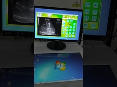 Fuente de onda fija Sistema de localización por ultrasonido de ondas de choque extracorporales