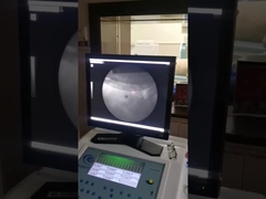 Máquina de ondas de choque extracorpórea de alta precisión, sistema de rayos X de litoripsia de choque rápido.